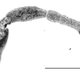 Una tenia adulta de Echinococcus multilocularis aislada de un zorro en Hungría.